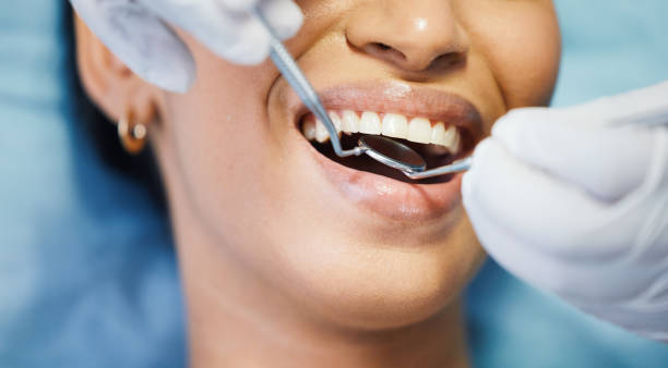 Best Emergency Root Canal Treatment in Mason, OH