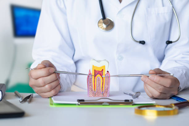 Best Emergency Wisdom Teeth Removal in Mason, OH